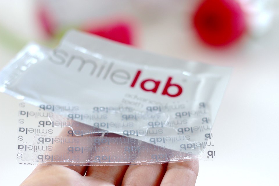 Smile lab ervaringen3