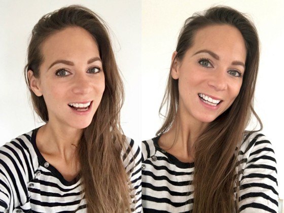 review-whitening-strips-smile-lab